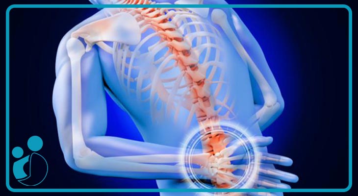 روش های جدید درمان دیسک کمر