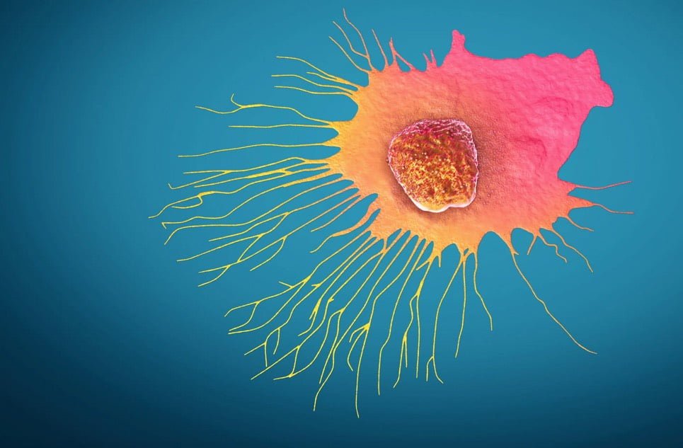 کشف پروتئینی که مختل کردن عملکرد آن برای پیشگیری از گسترش سرطان پستان،به بیماران کمک میکند