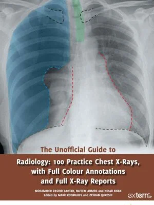 کتاب راهنمای غیررسمی رادیولوژی: ۱۰۰ تمرین تفسیر گرافی قفسه سینه ۲۰۱۷ ویرایش اول