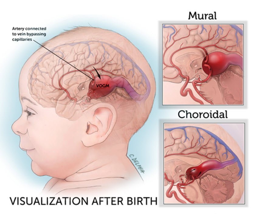 برای اولین بار در جهان، پزشکان عمل جراحی «مغز» را روی جنین داخل رحم انجام دادند