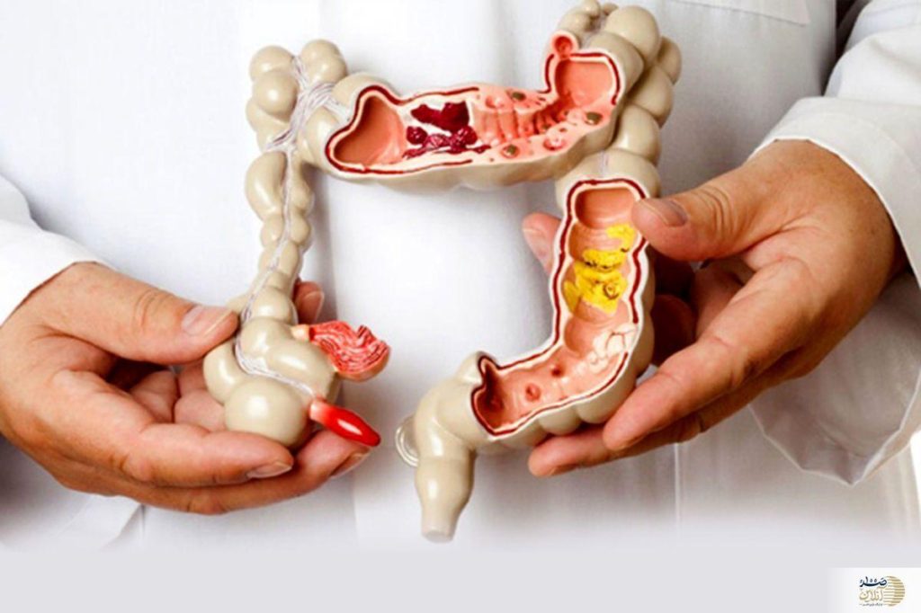 اگر این علایم و نشانه ها را دارید به سرطان خطرناک دچارید