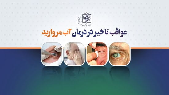 عواقب به تاخیر انداختن عمل آب مروارید