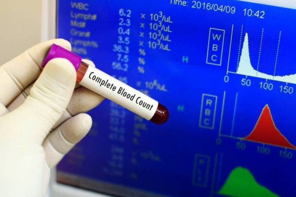 آموزش خواندن برگه آزمایش خون + جدول